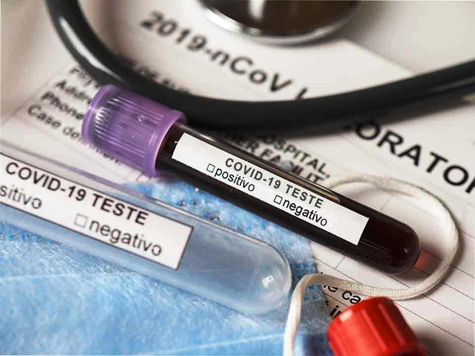 Conceição da Barra tem mais 2 infectados por Covid-19 e vai a 2.275 casos
