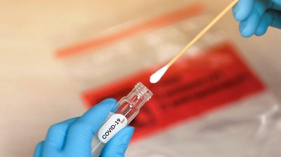 Em 24 horas, Brasil registra 228.954 casos e 672 mortes por covid-19