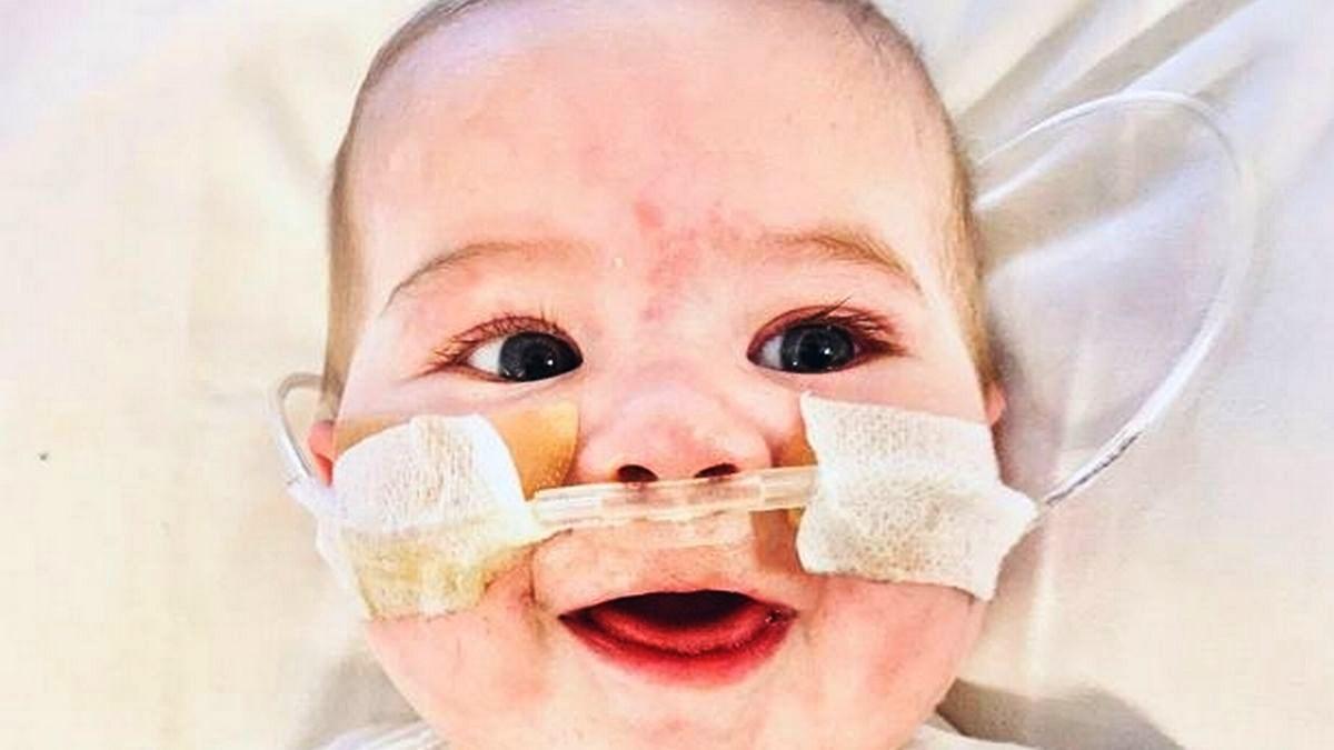 Bebê nasce com meio coração: 