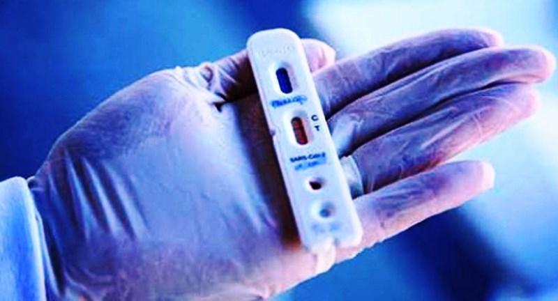 Com mais 70 infectados em 24 horas, Conceição da Barra vai a 4.830 casos de Covid-19