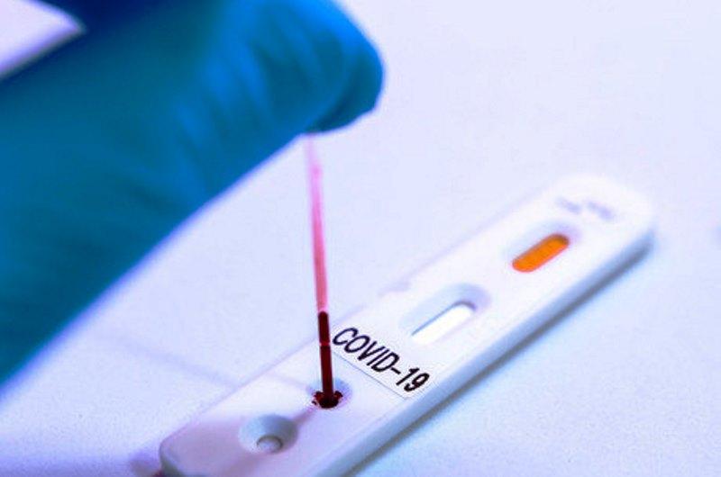 ES registra 201 novos casos de Covid-119 e 9 mortes nas últimas 24 horas