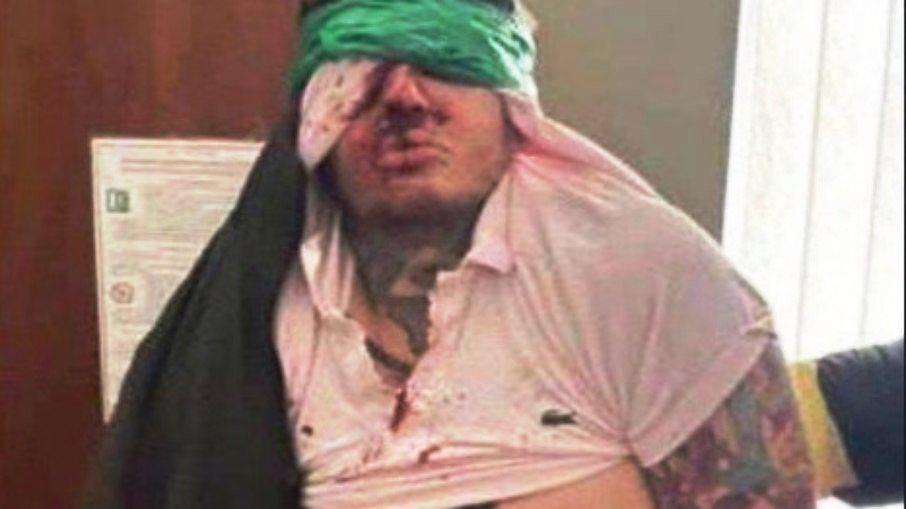 Grupo neonazista tortura e mata lutador de MMA na Ucrânia