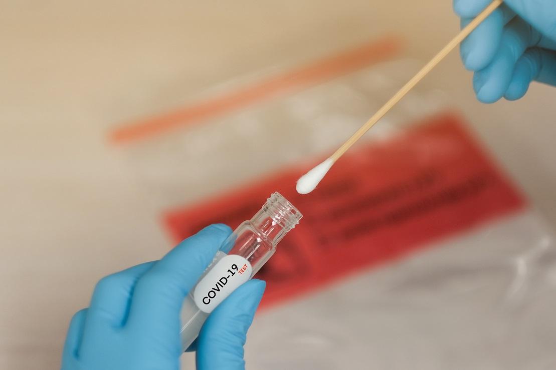 Conceição da Barra tem mais 1 infectado e número de casos de Covid-19 vai a 5.628