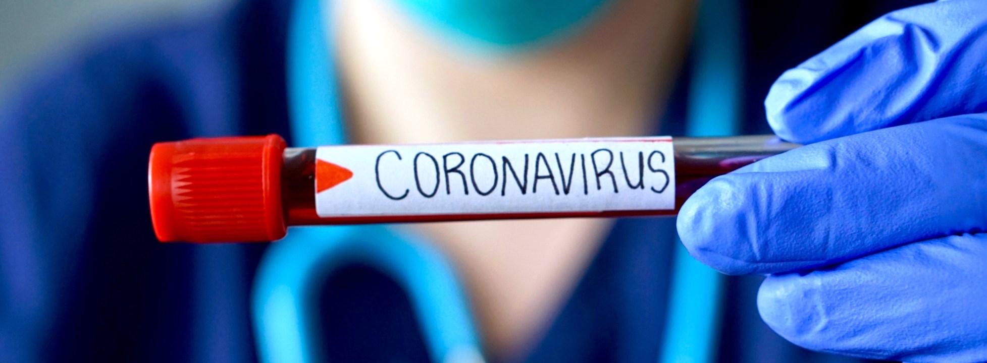 Conceição da Barra registra 1 infectado e casos de Covid-19 sobe para 5.629