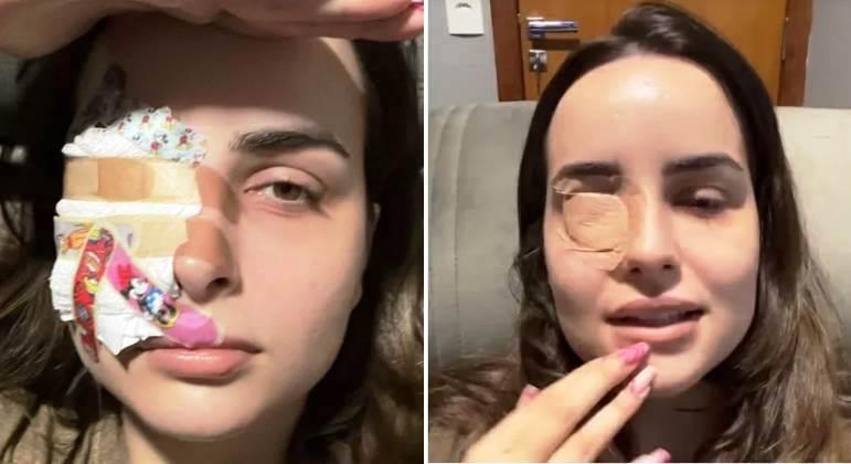 Influenciadora rasga parte da córnea ao coçar os olhos com as unhas grandes