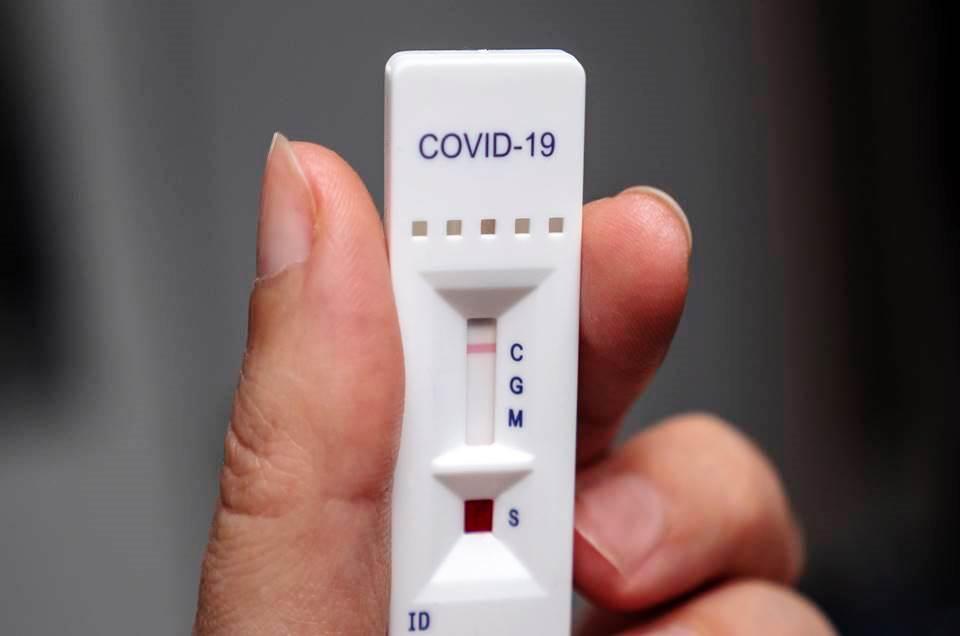 ES registra 59 novos casos e 6 mortes por Covid-19 nesta segunda-feira (28 