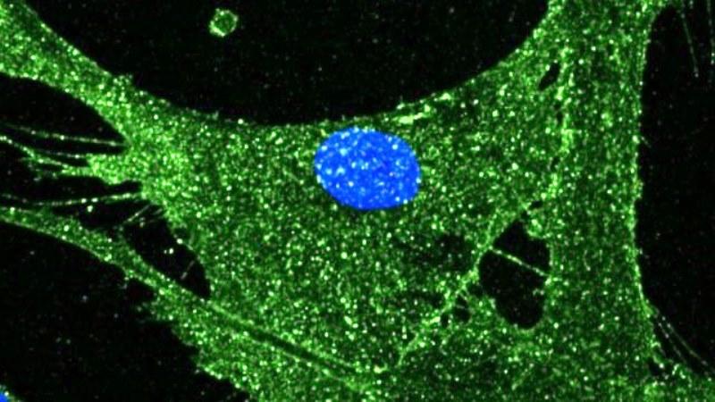 Cientistas rejuvenescem em 30 anos células de pele humana