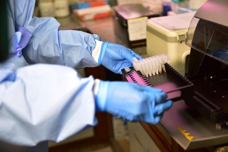 ES registra 119 novos infectados por Covid-19 e chega a 1.045.510 casos confirmados