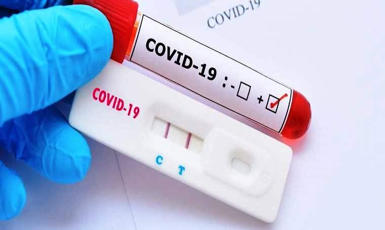 Conceição da Barra tem mais 1 infectado por Covid-19 e vai a 5.659 casos confirmados