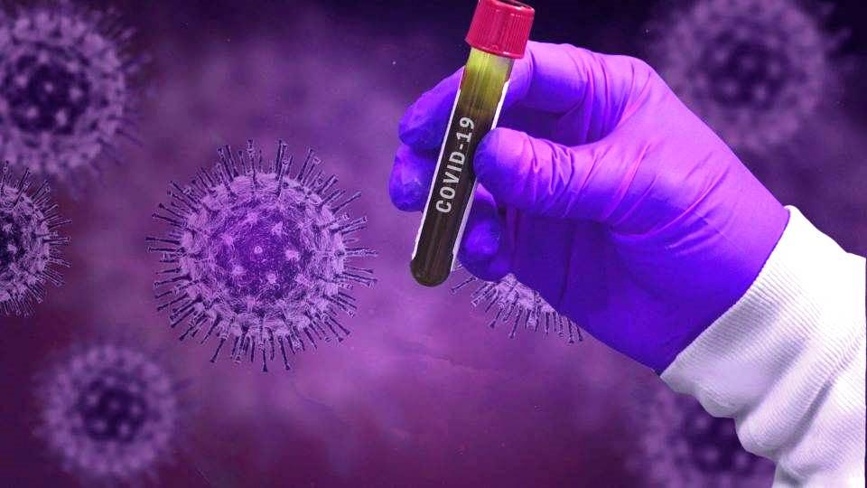 Com mais 1 infectado por Covid-19, Conceição da Barra chega a 5.660 casos confirmados