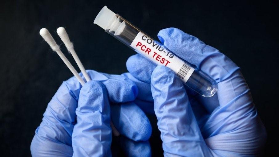 Brasil registra 60 mortes e 10 mil casos de covid-19 em 24 horas