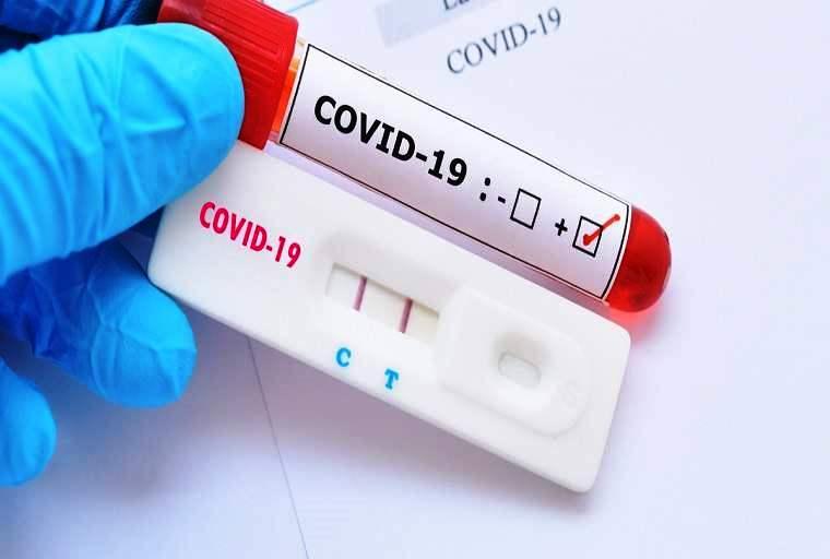 Conceição da Barra tem 1 novo infectado por Covid-19 e vai a 5.679 casos confirmados