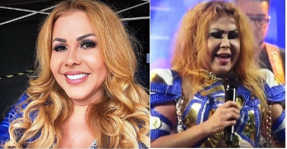 Internada, Joelma é diagnosticada com esofagite, gastrite e edema; cantora cancela três shows