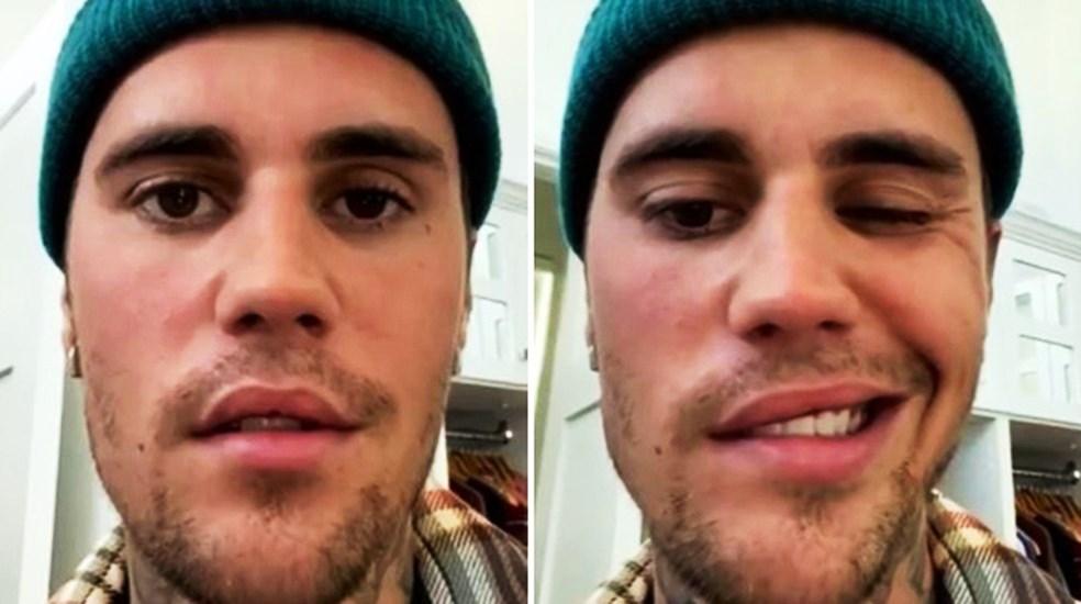 Justin Bieber mostra 'primeiros sinais' de recuperação da síndrome de Ramsay Hunt, diz médico