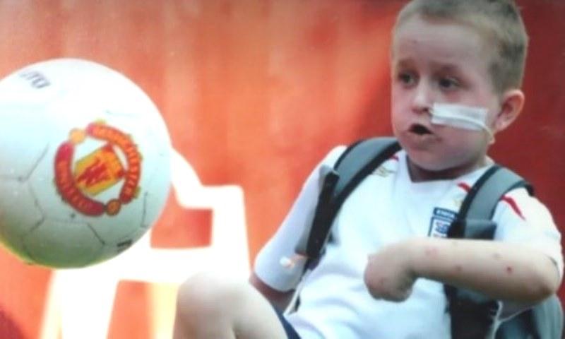 Menino mais alérgico do mundo morre na Inglaterra: “Queria ser normal”