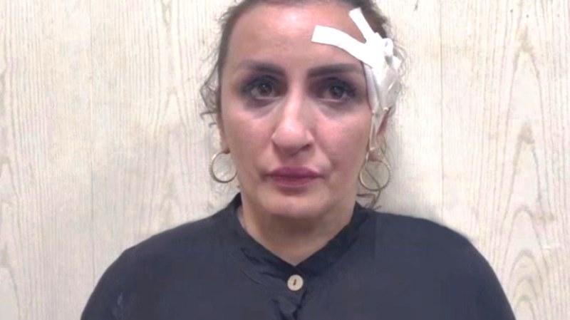 Mulher é presa acusada de vender o filho recém-nascido para pagar cirurgia plástica