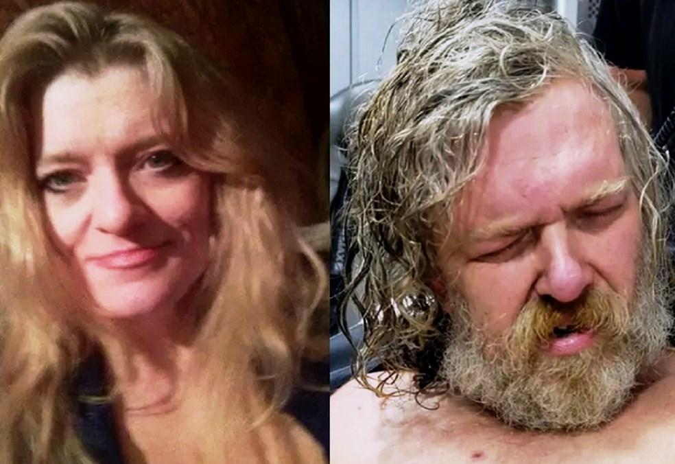 Mulher acorda de coma após dois anos e identifica irmão como agressor