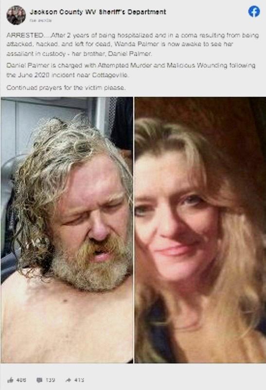 Mulher acorda de coma após dois anos e identifica irmão como agressor Mulher acorda de coma após dois anos e identifica irmão como agressor