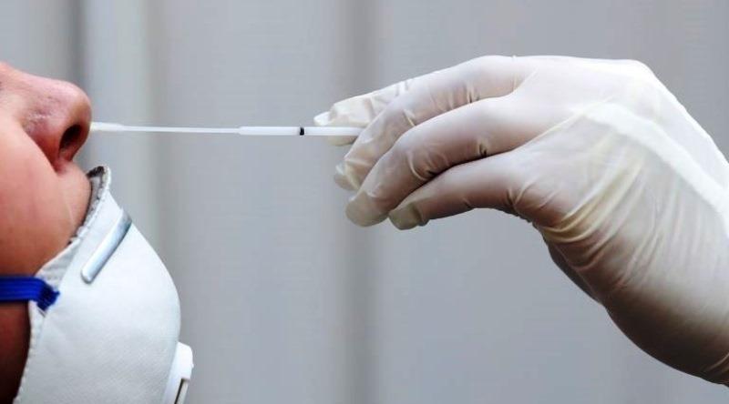 Com mais 1 infectado, Conceição da Barra chega a 6.434 casos de Covid-19