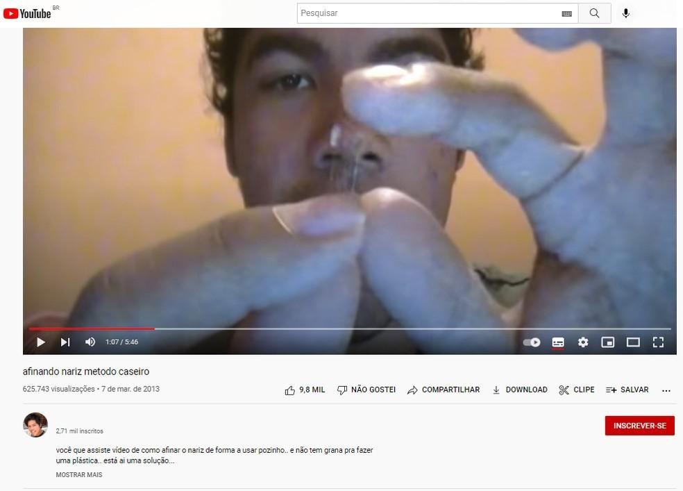 Médicos apontam riscos na ‘rinoplastia caseira’; em SP, homem foi internado ao tentar operar nariz