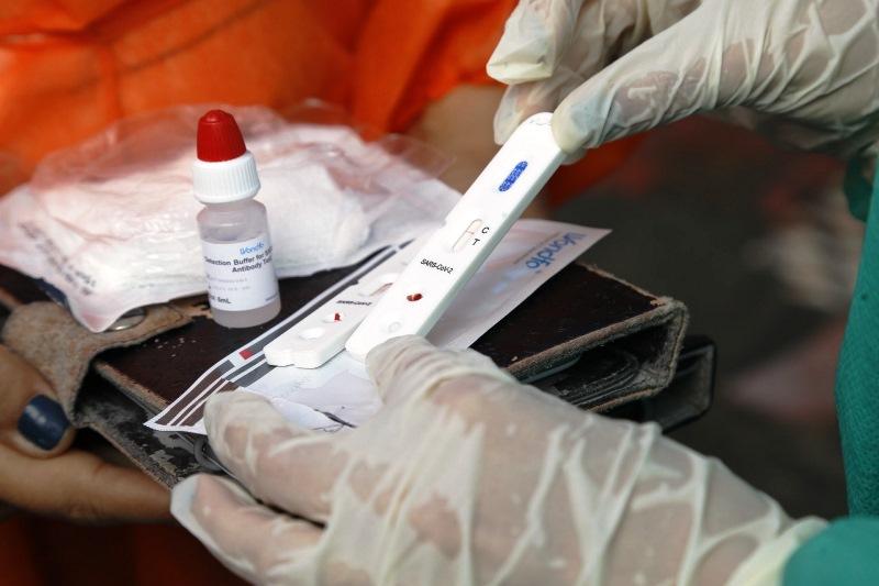Com mais 4 infectados por Covid-19, Conceição da Barra vai a 6.605 casos confirmados