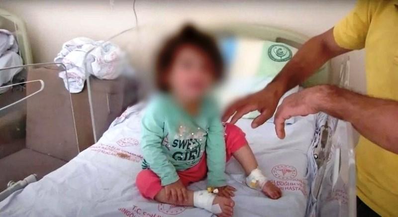 Menina de dois anos mata cobra com mordidas após levar picada no lábio