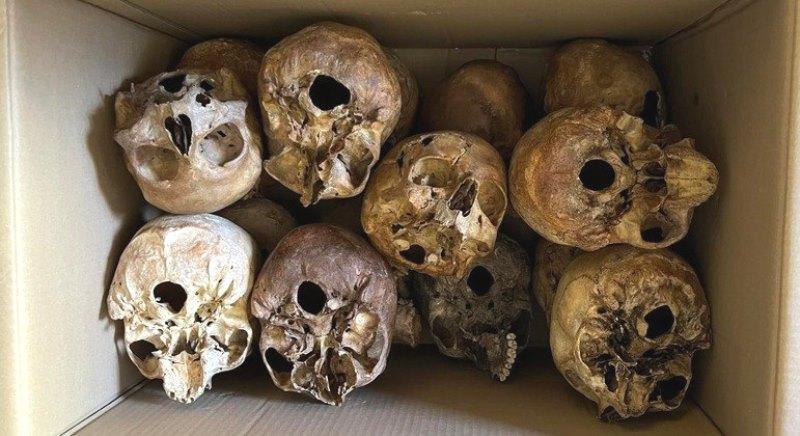 Americano é preso após tentar comprar restos humanos roubados