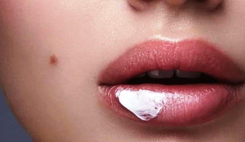 Saiba como tratar e prevenir o ressecamento labial