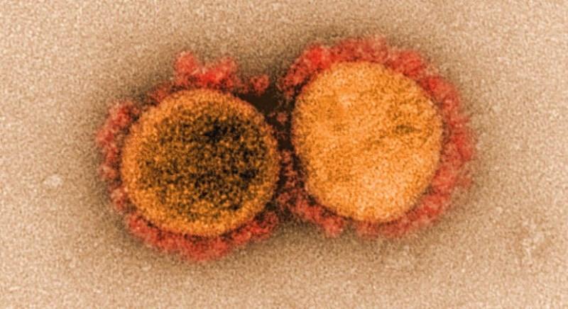Vacina contra a Covid-19 desenvolvida por brasileiros está pronta para testes em humanos