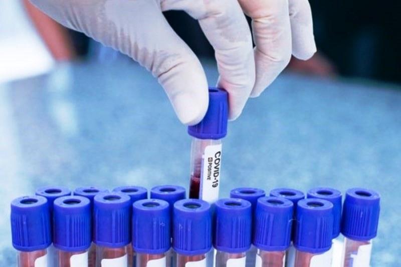 Em 24 horas país registra 182 mortes e quase 15 mil novos de Covid-19 casos