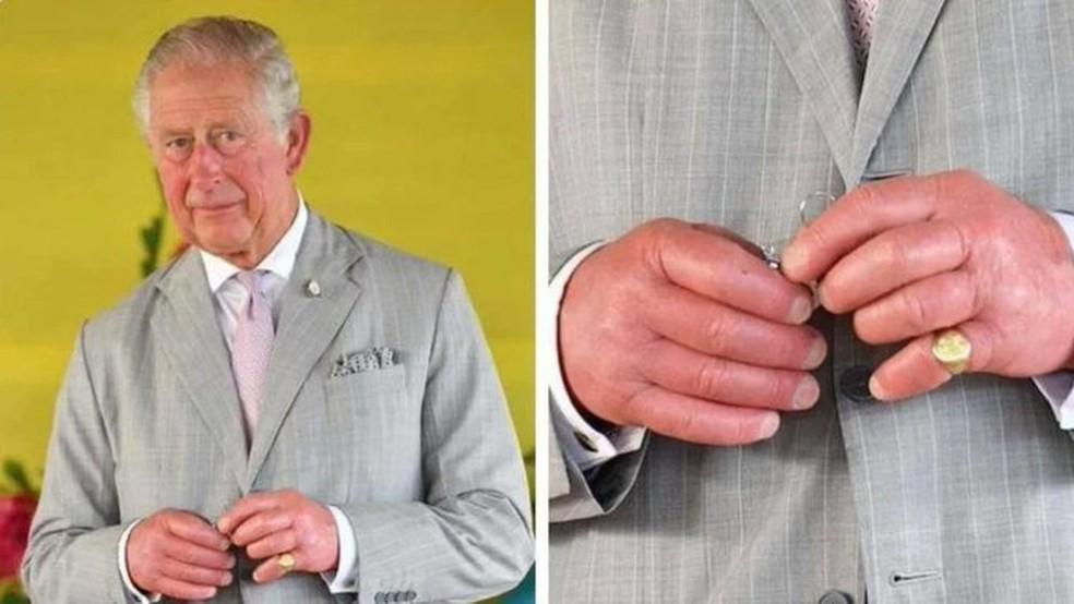 O que há de errado com os dedos inchados do rei Charles III: veja possíveis causas