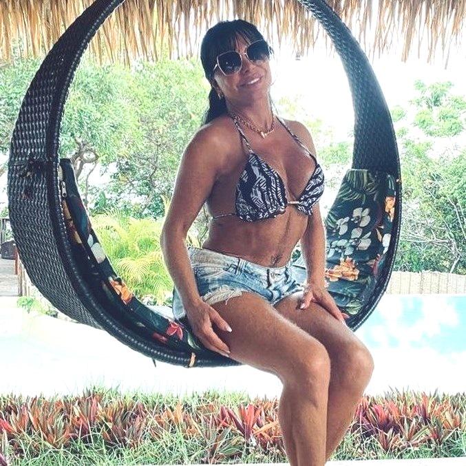 Gretchen passa por cirurgia plástica íntima: Entenda o que é e quais são os riscos do procedimento