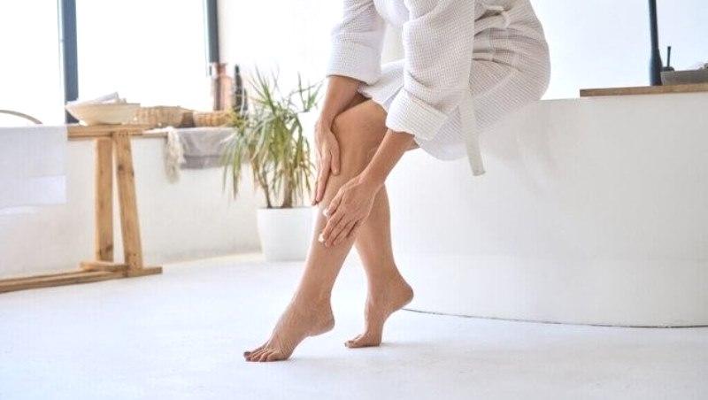 4 mitos sobre tratamentos contra varizes