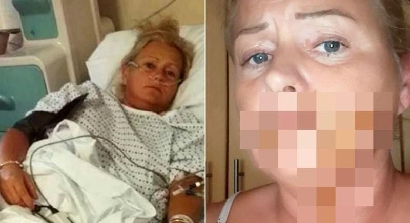Mulher passa três dias no hospital após chihuahua defecar na boca dela