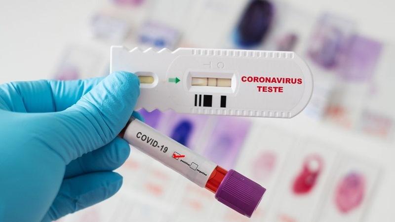 ES tem mais 48 infectados em 24 horas e soma 1.215.807 casos de Covid-19
