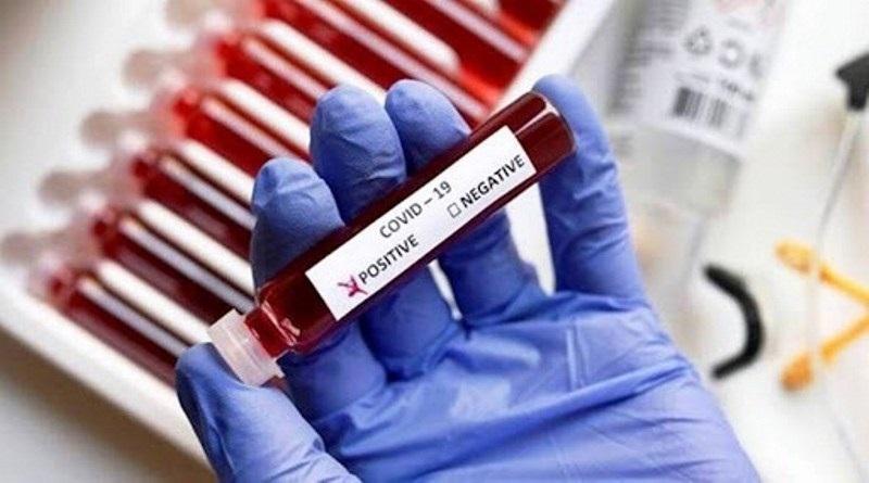 Conceição da Barra tem 25 novos infectados e chega a 7.109 casos de Covid-19