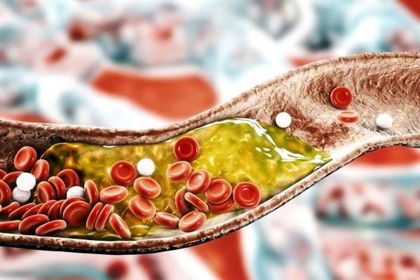 Médicas listam dicas para melhorar a saúde e reduzir o colesterol ruim