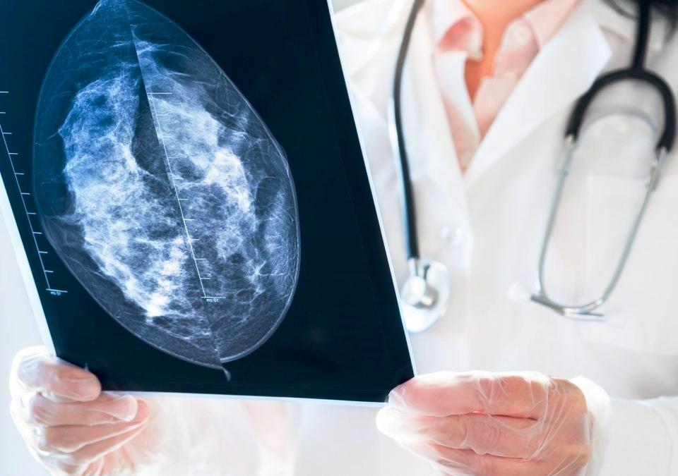 Em 1 ano, apenas 16,4% das mulheres realizaram o exame de mamografia, mostra estudo técnico do TCE-ES