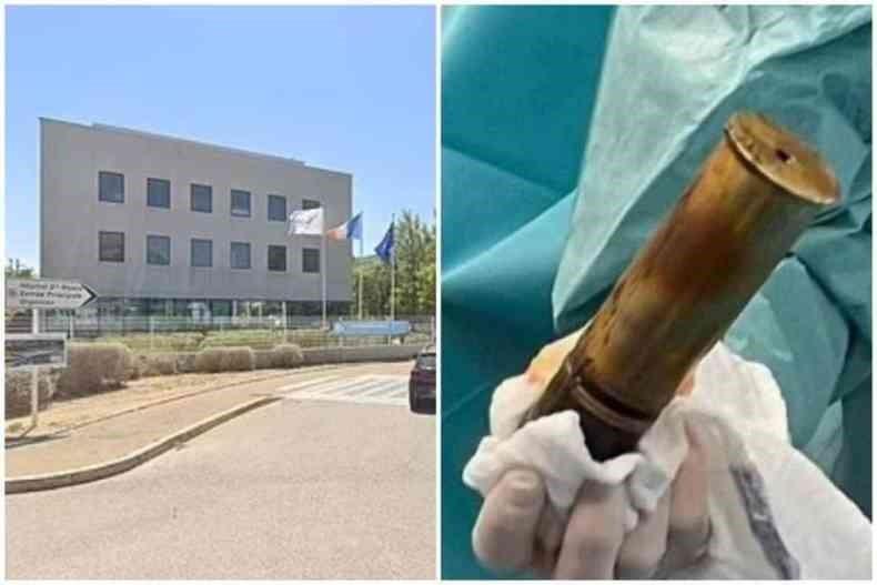 Homem dá entrada em hospital com bomba no ânus e local tem de ser esvaziado