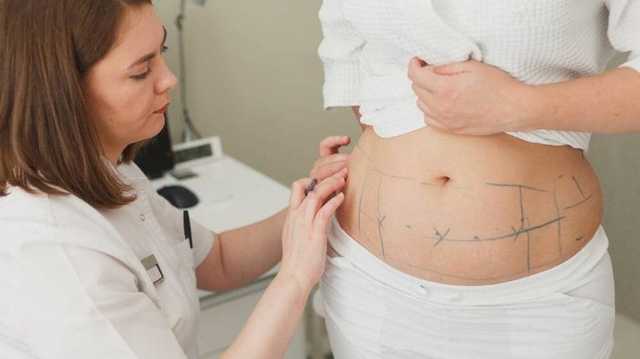 Lipo é a intervenção mais procurada pelas mulheres