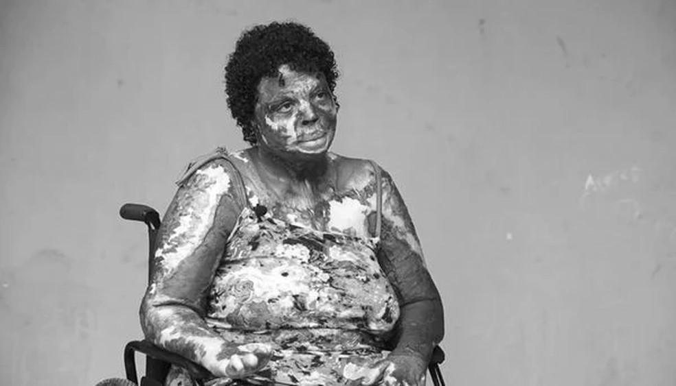 “Eu já sabia que ele ia morrer”, diz filho de diarista queimada pelo ex ao saber da morte do pai