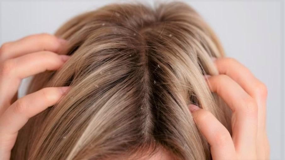 Couro cabeludo também envelhece: saiba como prevenir o processo