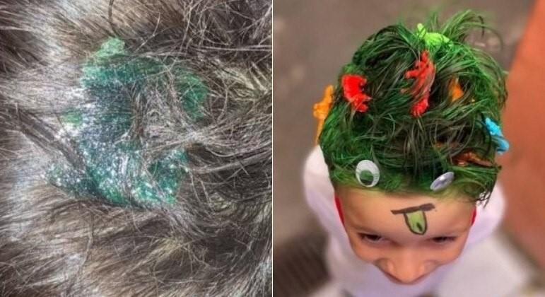 Mãe usa cola permanente para fazer ‘penteado maluco’ no filho: ‘Solução é raspar’