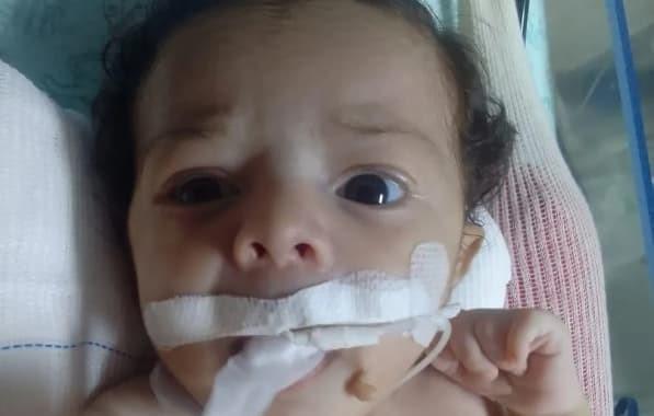Bebê de 2 meses morre após receber leite injetado na veia ao invés de remédio