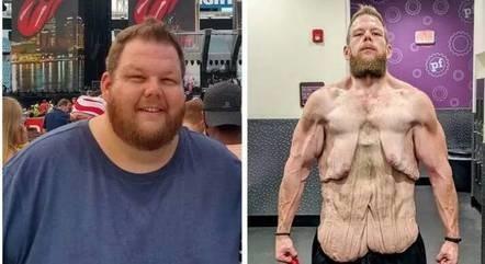 Homem perde 163 kg em dois anos, sem fazer cirurgia, e luta contra o excesso de pele