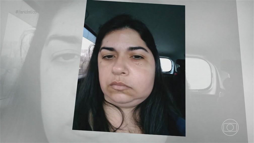 Jovem morre após complicação na extração de dentes do siso; mãe relembra queixa da filha