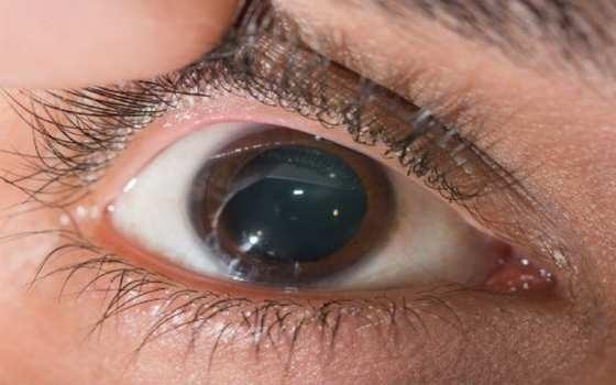 Oftalmologistas alertam para risco de suplementos com promessa de cura