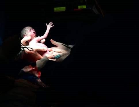 Sêxtuplos capixabas: veja as primeiras fotos dos bebês após o parto