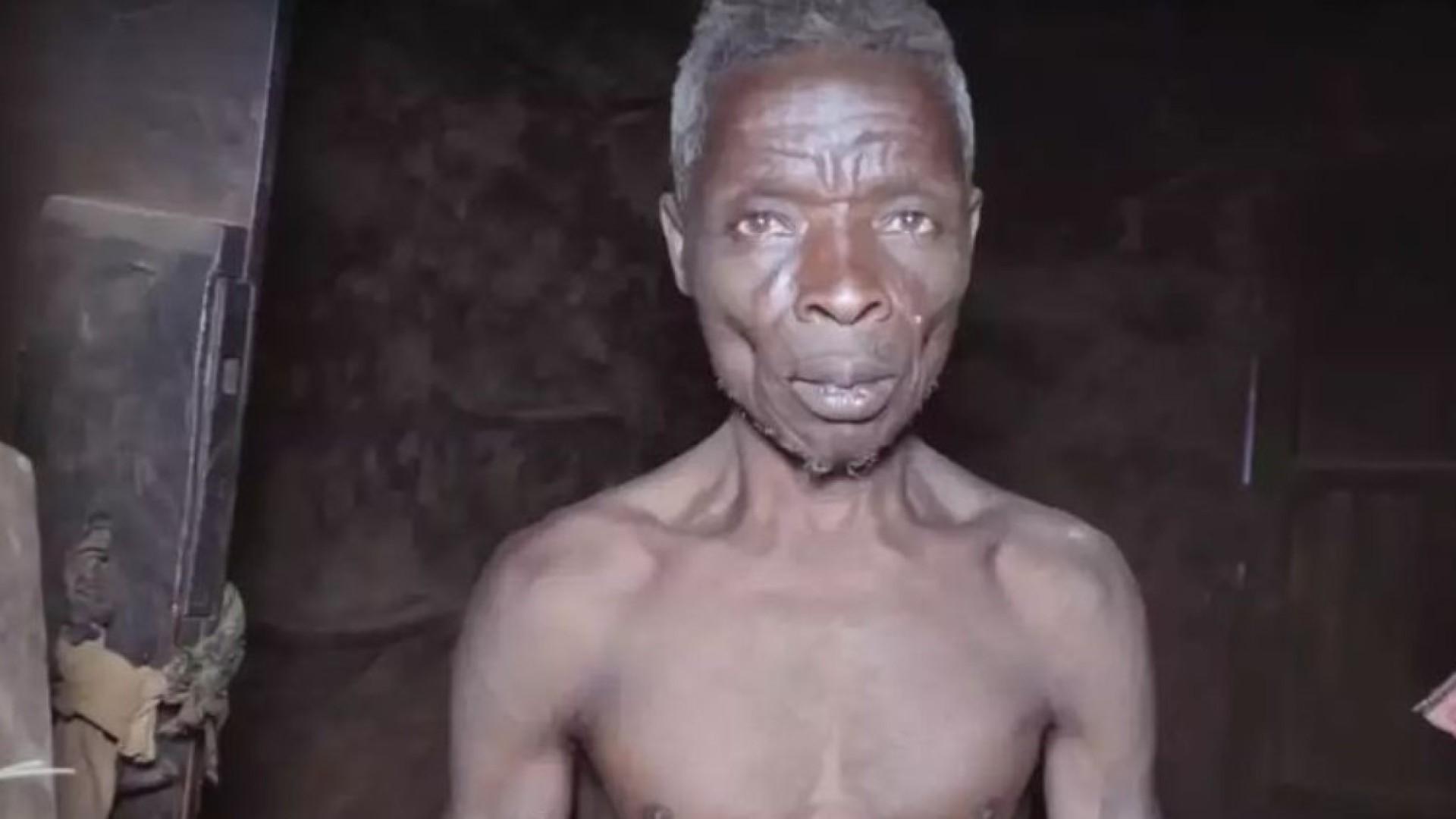 Homem que tem fobia de mulheres vive isolado a 55 anos: “Deixam-me com medo”