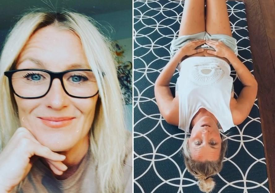 Australiana revela ter nascido sem vagina: ‘Parecia uma Barbie’